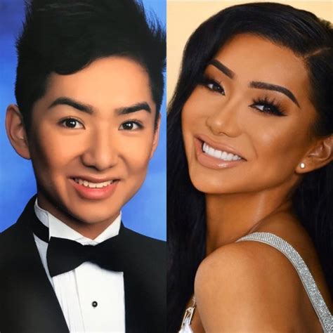 nikita dragun before surgery|Nikita Dragun 